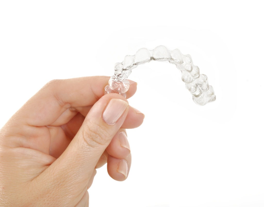 Fix Your Overbite with Invisalign